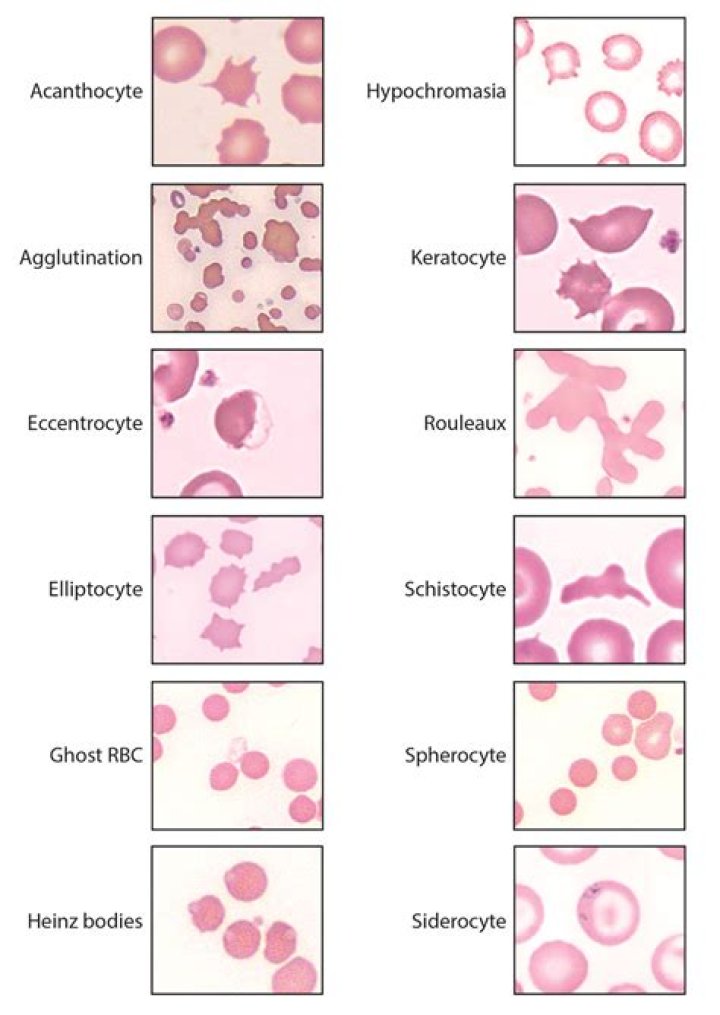 Are erythrocytes considered cells