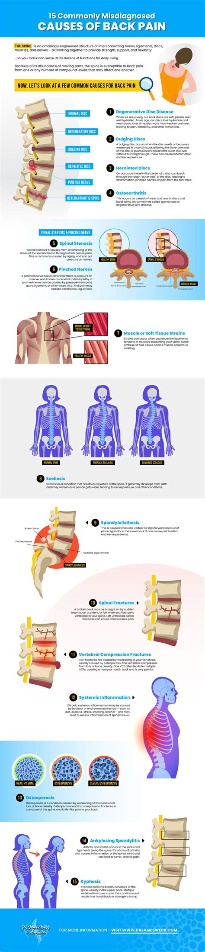 Can a bad pillow affect your back