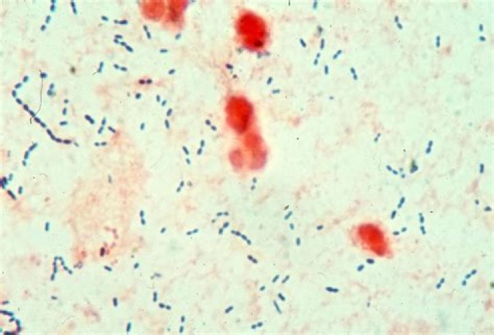 Can mycoplasma be Gram stained