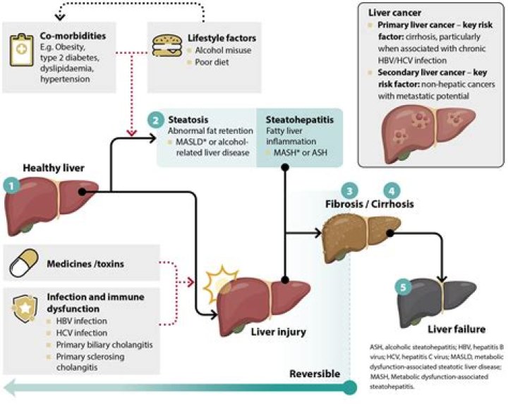 Does fasting affect liver enzymes