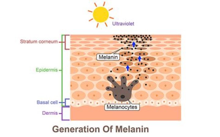 Does hypopigmentation go away