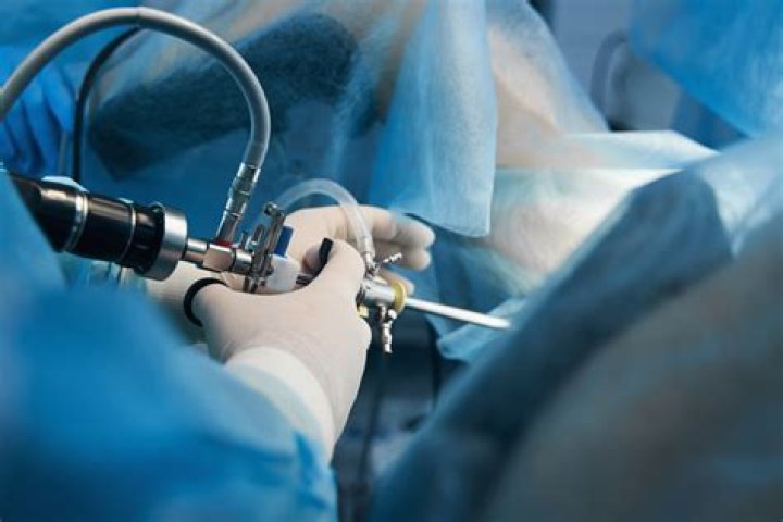 Does Medicare Cover vein ablation
