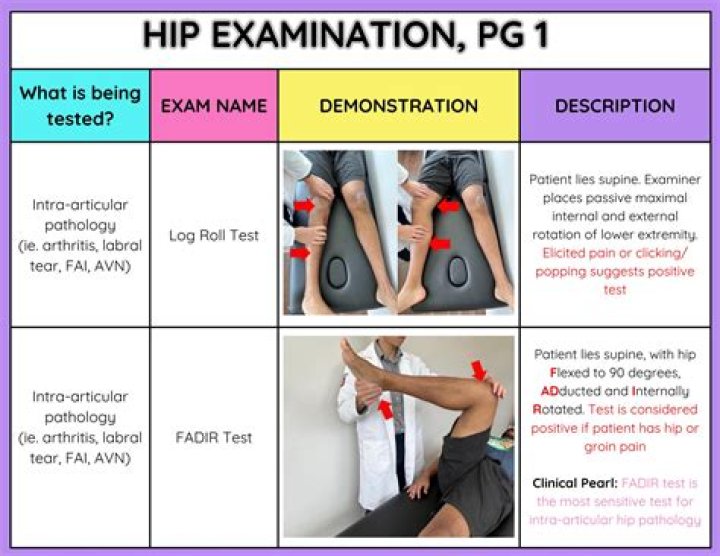 How do you perform a hip exam