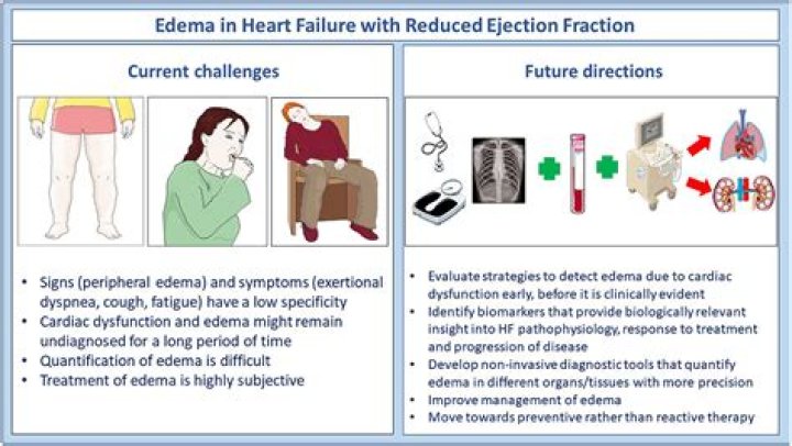 How do you reduce heart edema