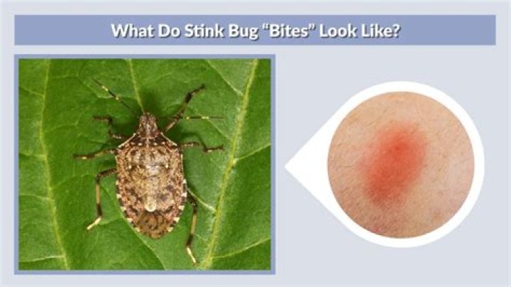 Is a stink bug bite harmful