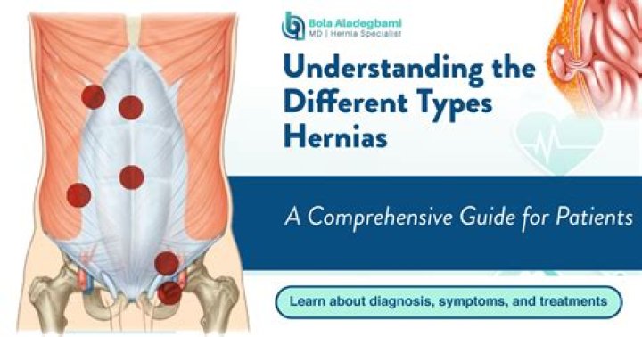 What are some types of hernias