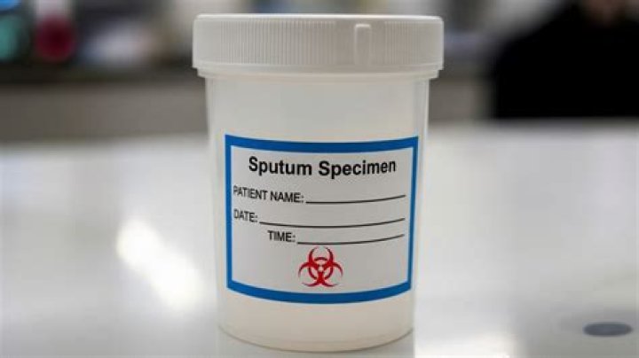 What can a sputum test detect