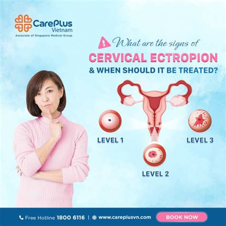 What can cause cervical ectropion