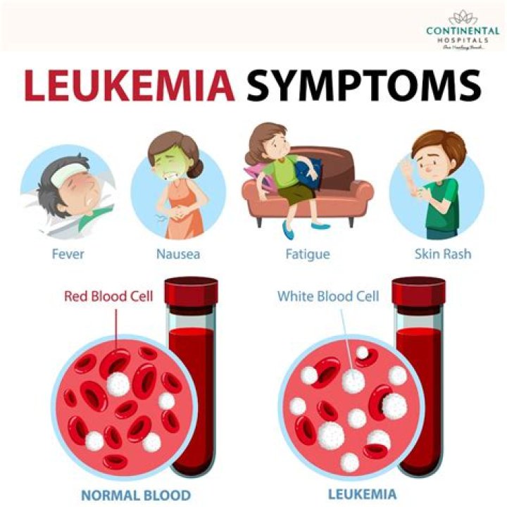 What can leukemia be mistaken for