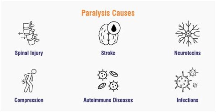What causes rigid paralysis