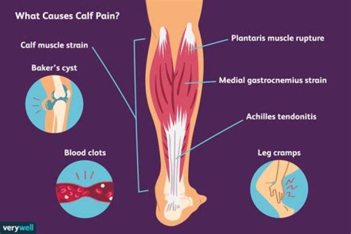 What causes weak calf syndrome