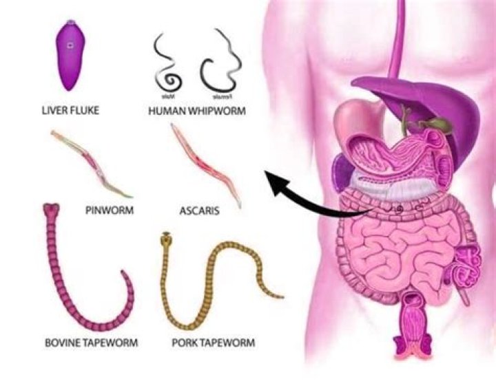 What do whipworms do to humans