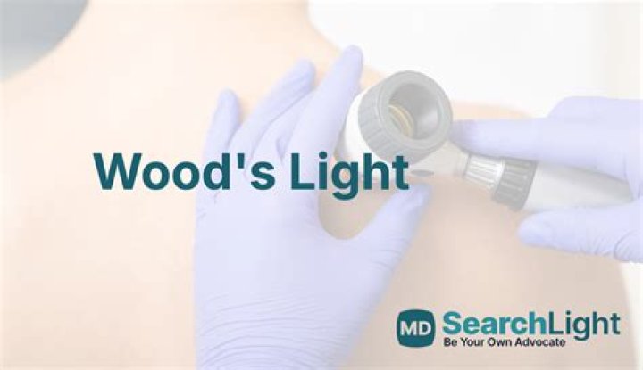 What does a Woods lamp detect