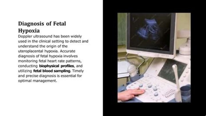What does fetal hypoxia cause