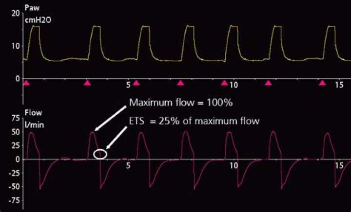 What is expiratory sensitivity