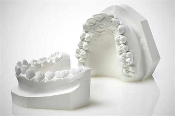 What is gypsum used for in dental