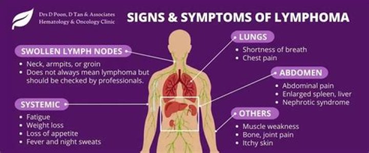 What is lymphoma cough like