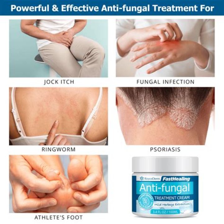 What kills a fungal infection