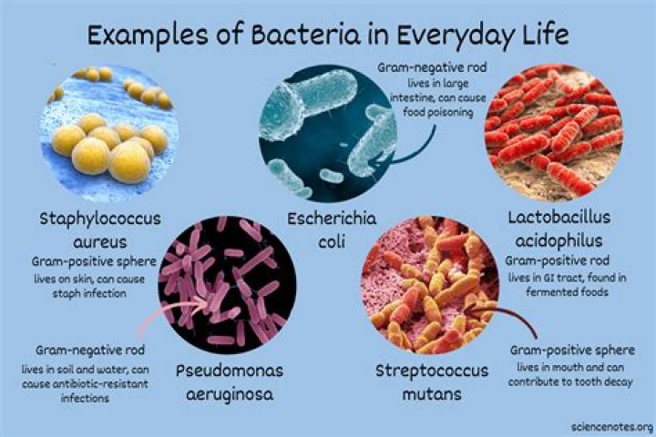 Where are bacteria commonly found
