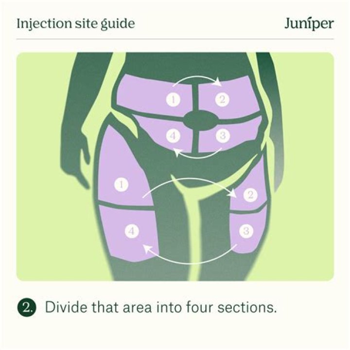 Where do you inject Restylane