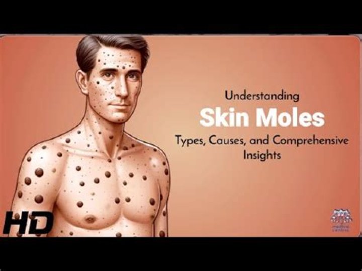 Why is mole skin called mole skin