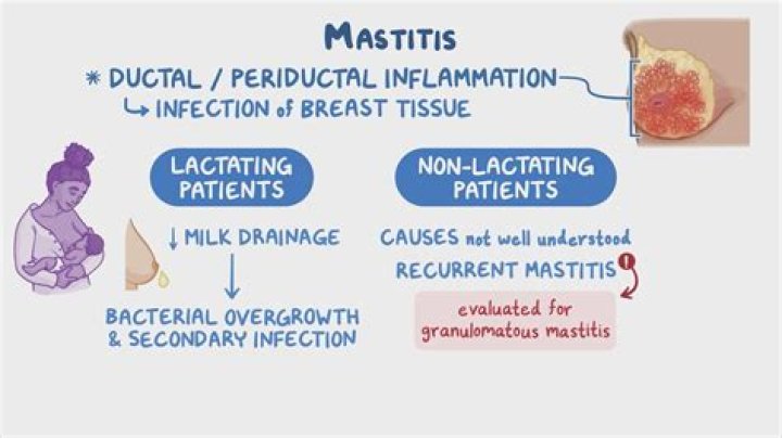 Will mastitis clear up on its own