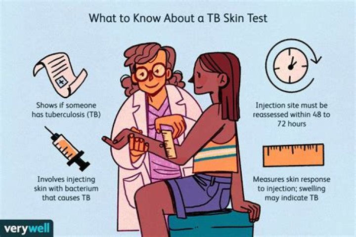 Will redness from TB test go away